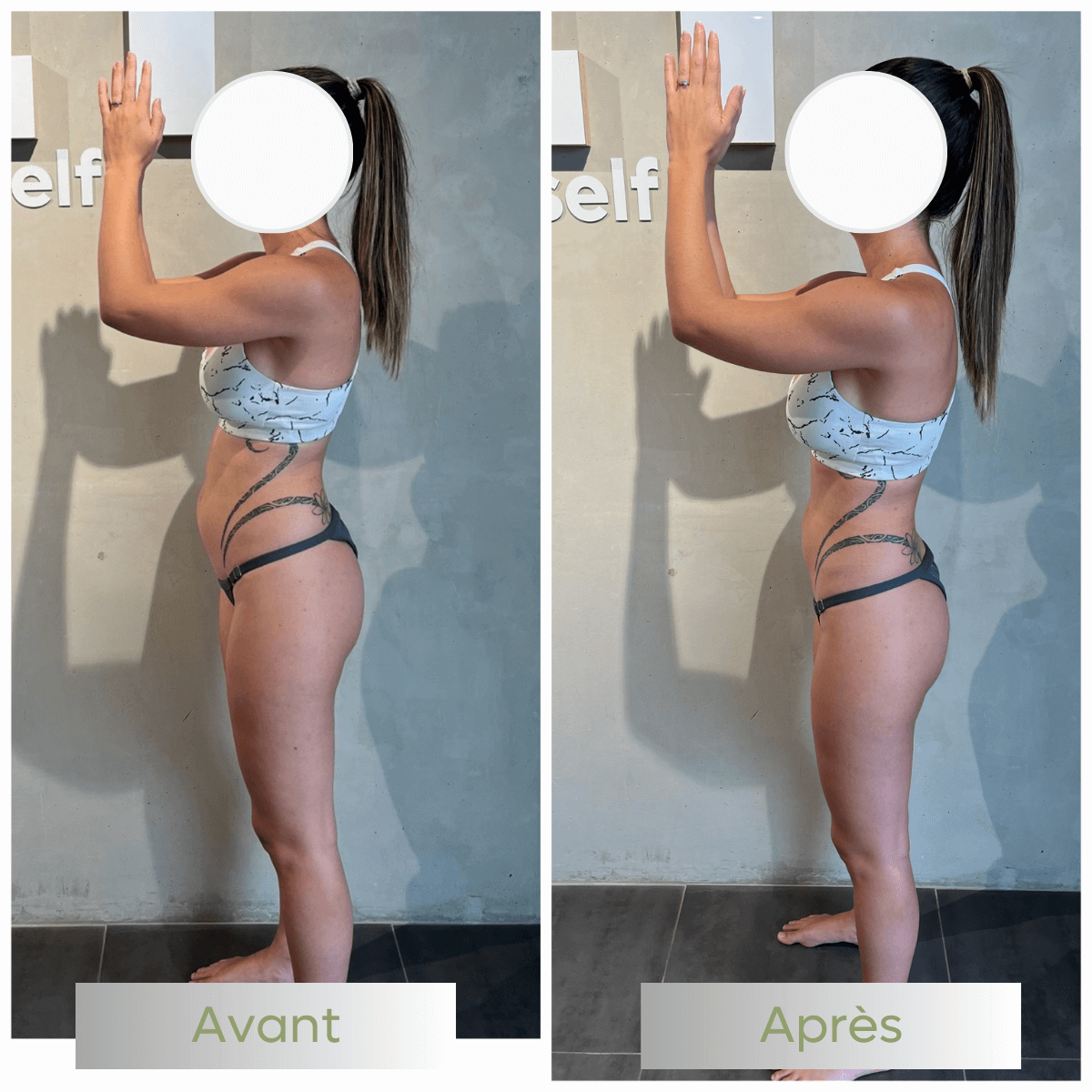 01-avant-apres-befitnc