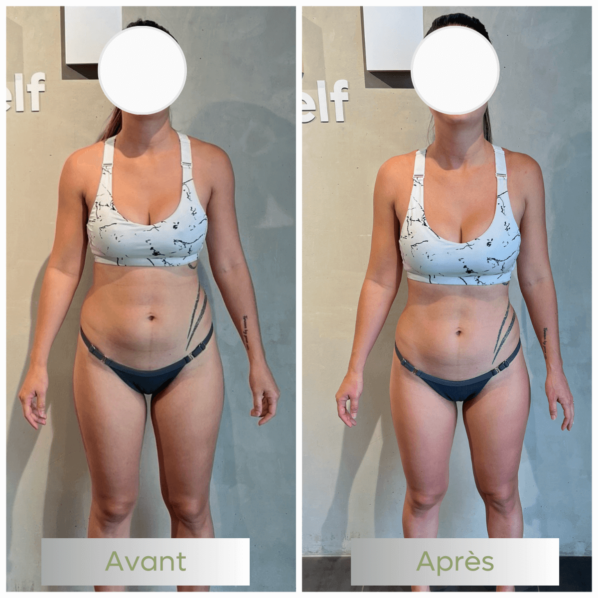 02-avant-apres-be-fit-nc