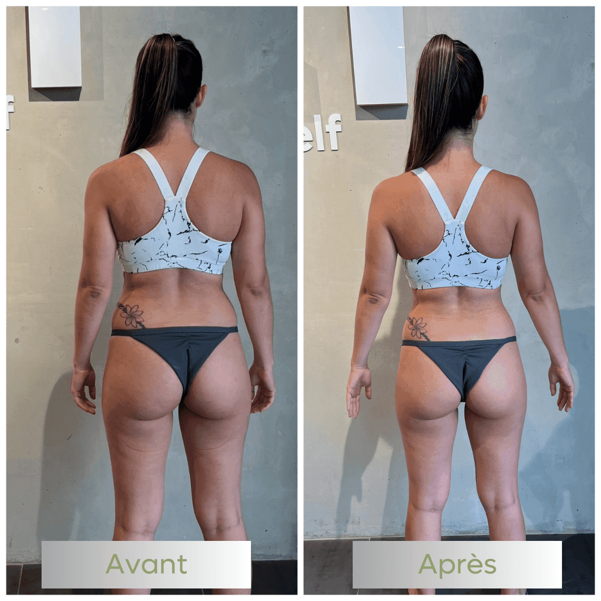 03-avant-apres-be-fit-nc